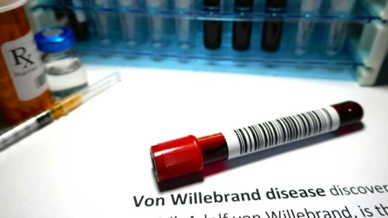 von Willebrand disease children