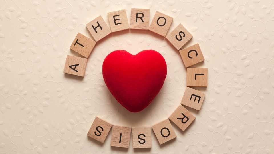 Atherosclerosis: Causes, Symptoms, Treatment And Prevention