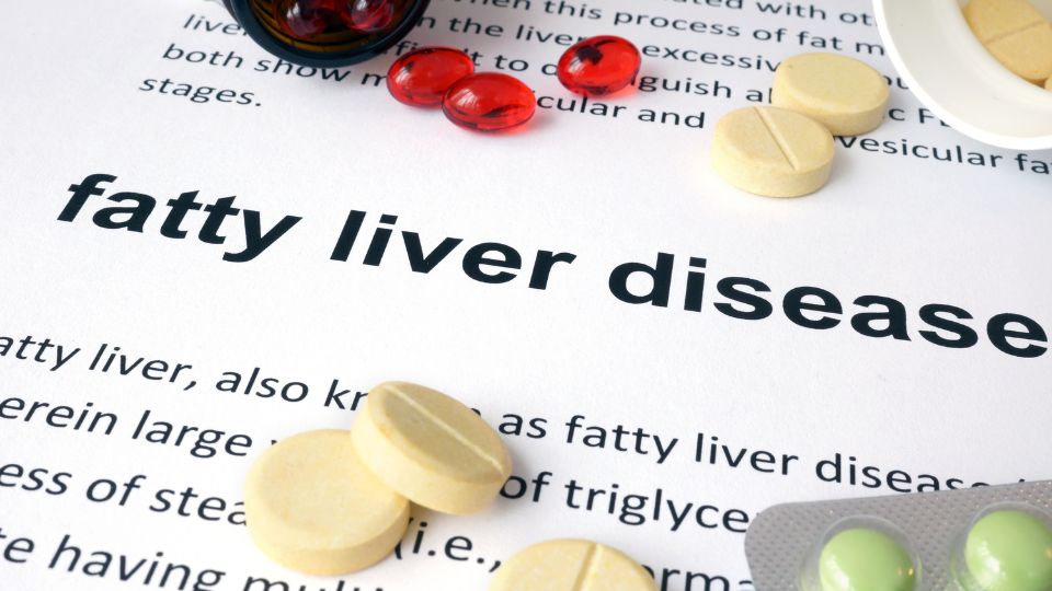 Fatty liver diseases